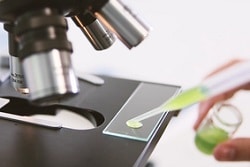 Auf einem schwarze Mikroskop wird ein Tropfen der Mikroalge Chlorella mit einer Pinzette getan.